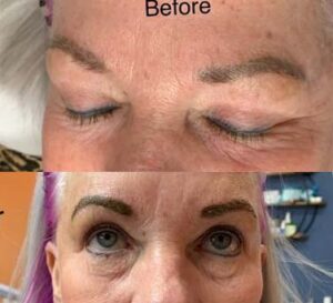 Botched Permanent Makeup Correction